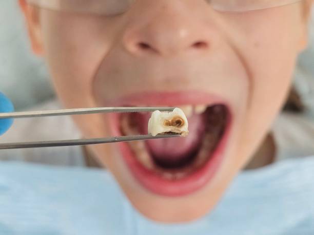Best Emergency Cosmetic Dentistry (e.g., broken veneers) in Georgetown, IN